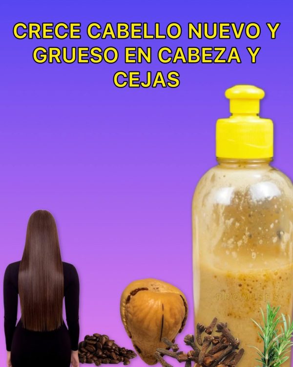 SOLO LAVA EL CABELLO CON ESTE CHAMPU Y TE NACE PELO HASTA EN LA FRENTE