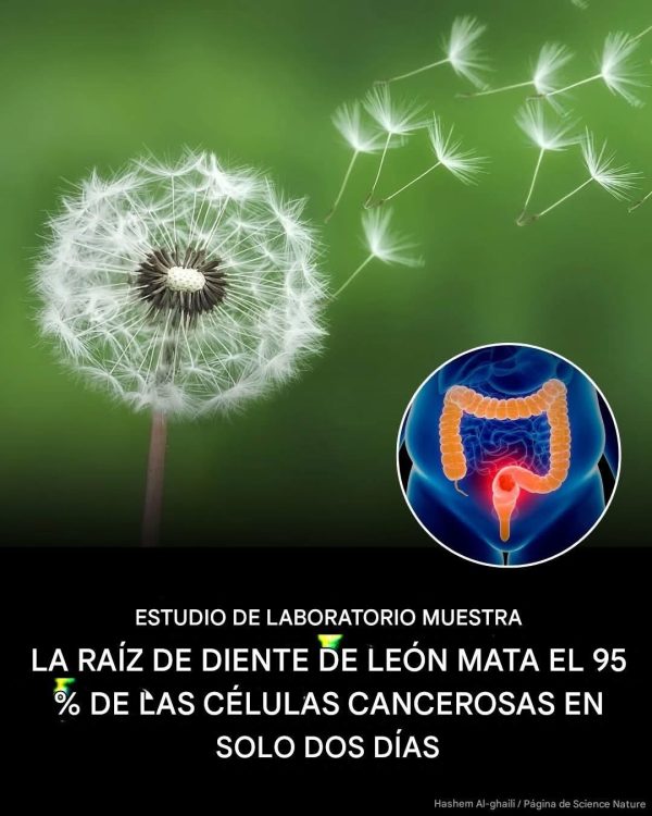 Raíz de diente de león