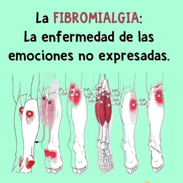 Fibromialgia: más allá de la frase “la enfermedad de las emociones no expresadas”
