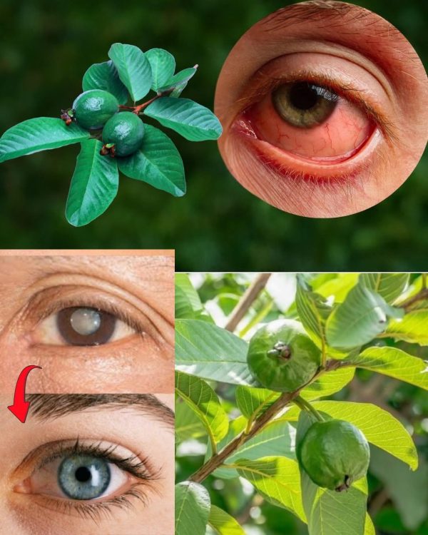 Cómo usar la guayaba para tratar problemas oculares | Remedios naturales para los ojos
