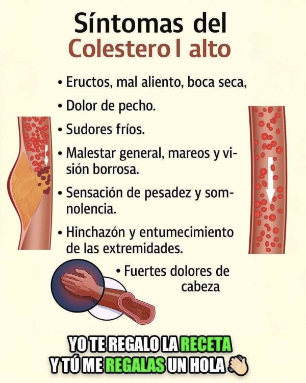 Síntomas del Colesterol Alto y Recetas Naturales para Apoyar un Estilo de Vida Saludable