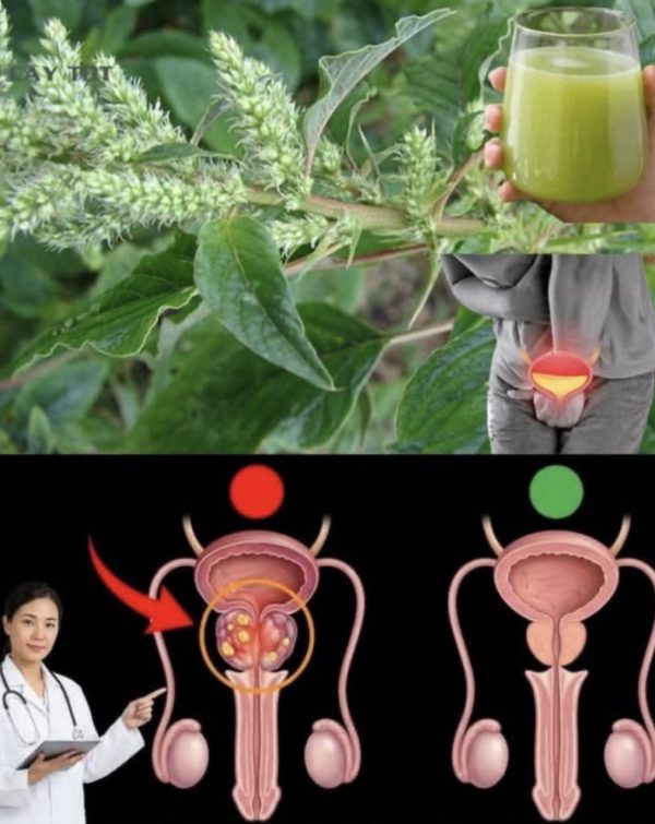Ningún Hombre Debería Morir de Cáncer de Próstata: Amaranto como Remedio Natural