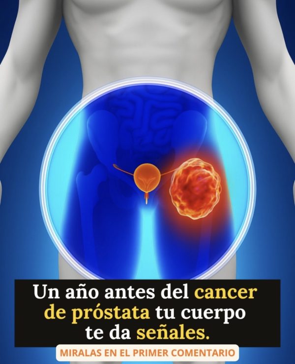 Cáncer de próstata: 5 señales tempranas que todo hombre debe conocer.