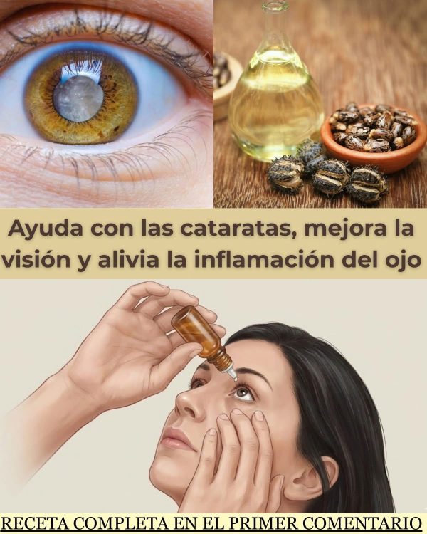 Remedio Natural para Cataratas e Inflamación Ocular