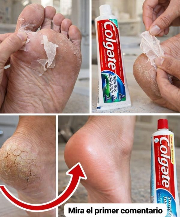 Cómo Cuidar la Piel de Tus Manos y Brazos de Forma Natural para un Aspecto Más Suave y Uniforme