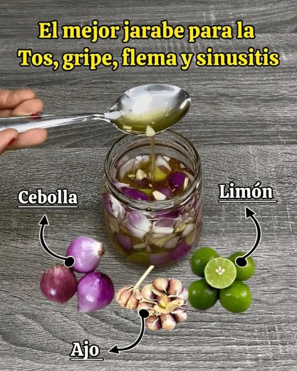 ¡Adiós Tos y Flemas con un Jarabe Mágico de Tu Cocina!