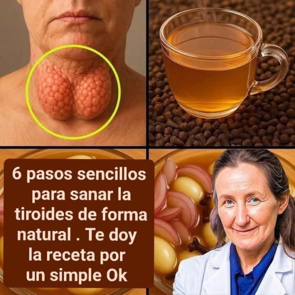 6 pasos sencillos para sanar la tiroides de forma natural . Te doy la receta por un simple ….. Ver mas