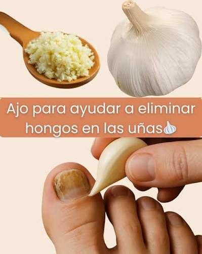 El ajo: un remedio natural y efectivo contra los hongos en los pies