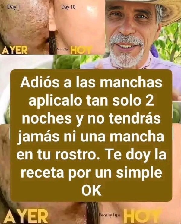 MUJER APLICO ESTO EN SUS ARRUGAS Y EN 5 MINUTOS QUEDO ESPANTADA I HUEVO Y VASELINA PARA ELIMINAR LAS ARRUGAS