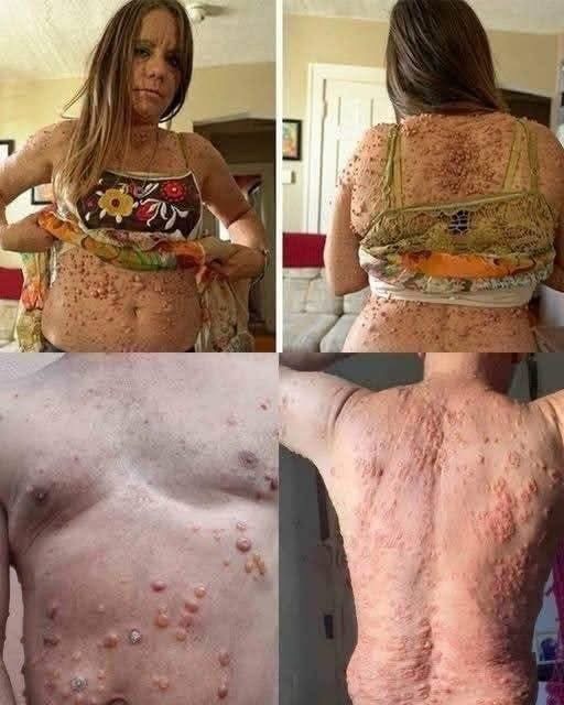 Hábitos al dormir que pueden arruinar tu piel silenciosamente