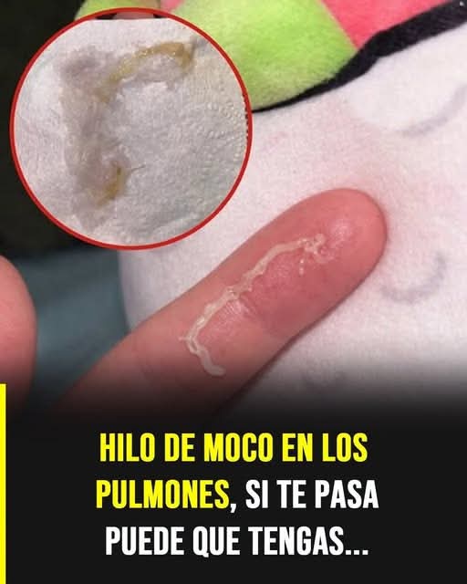 Mucosidad filamentosa proveniente de los pulmones: