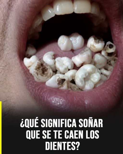 Que pasa si sueño con dientes