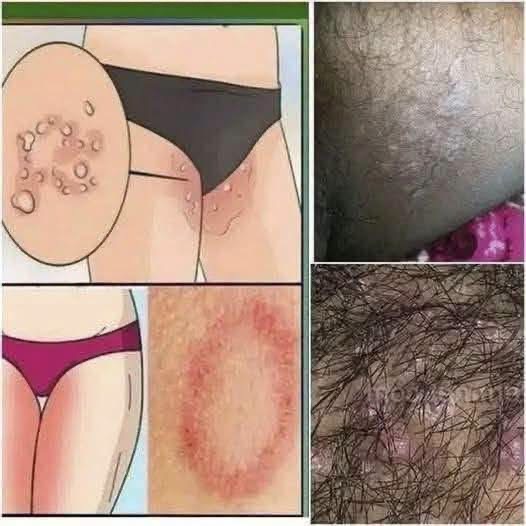¡Cuidado con la ropa apretada!