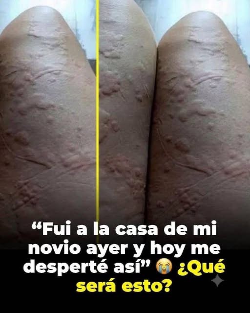 Tipos de Erupciones en la Piel: Causas, Síntomas y Cuándo Consultar