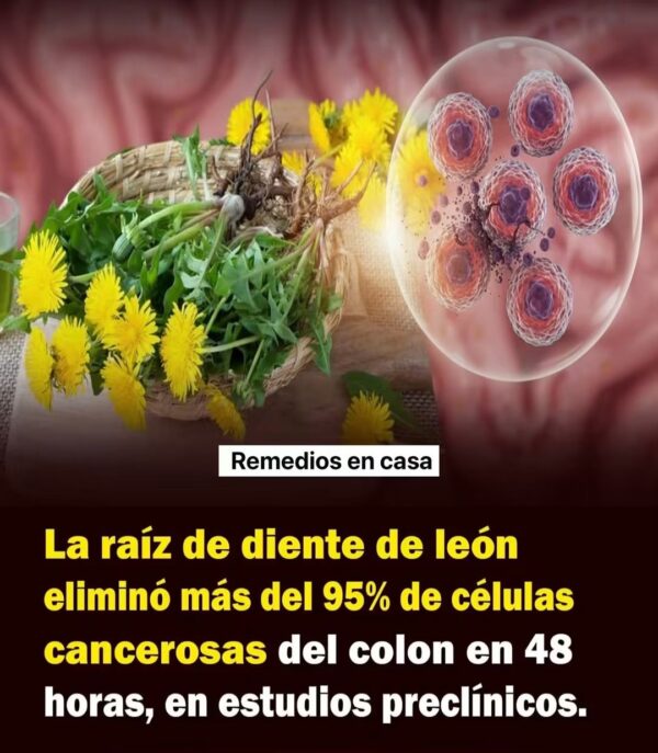 La raíz de diente de león