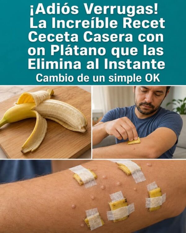 El secreto de la cáscara de plátano