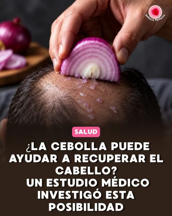 la caída del cabello?
