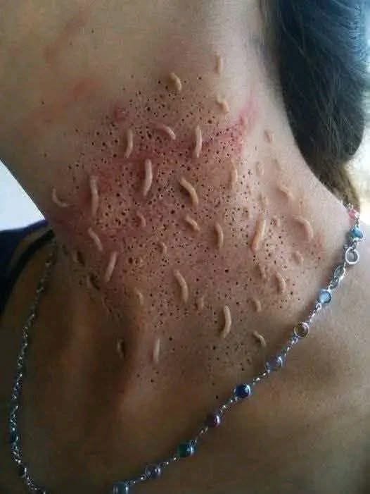 “ESTAS SON LAS CONSECUENCIAS DE ACOSTARSE CON TU C…” LA IMPACTANTE IMAGEN QUE CIRCULA EN REDES